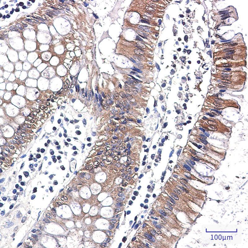 Anti-Caspase 7 Rabbit Monoclonal Antibody