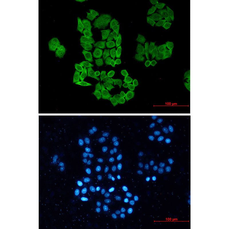 Anti-CCT2 Rabbit Monoclonal Antibody