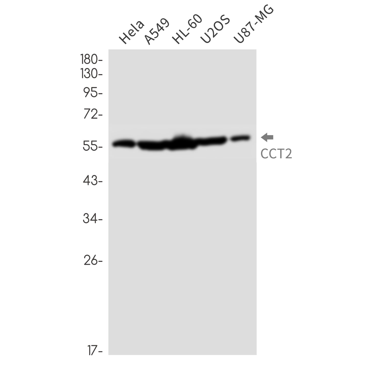 Anti-CCT2 Rabbit Monoclonal Antibody