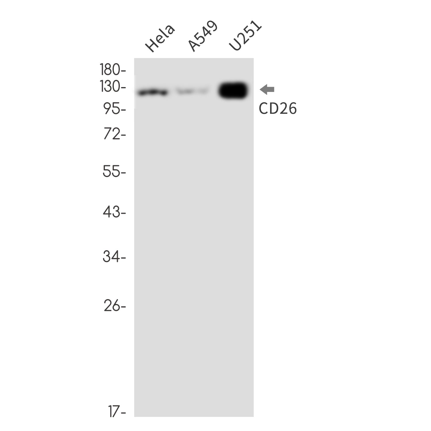 Anti-CD26 Rabbit Monoclonal Antibody