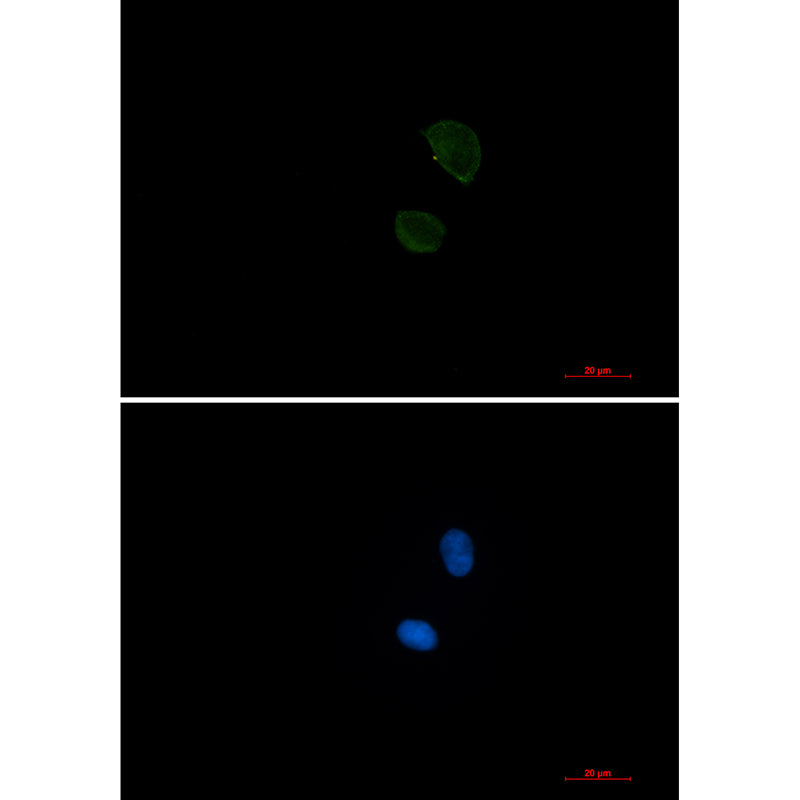 Anti-CD99 Rabbit Monoclonal Antibody