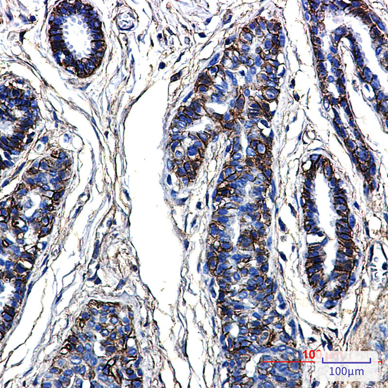 Anti-CD99 Rabbit Monoclonal Antibody