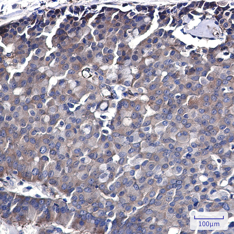 Anti-CDC37 Rabbit Monoclonal Antibody