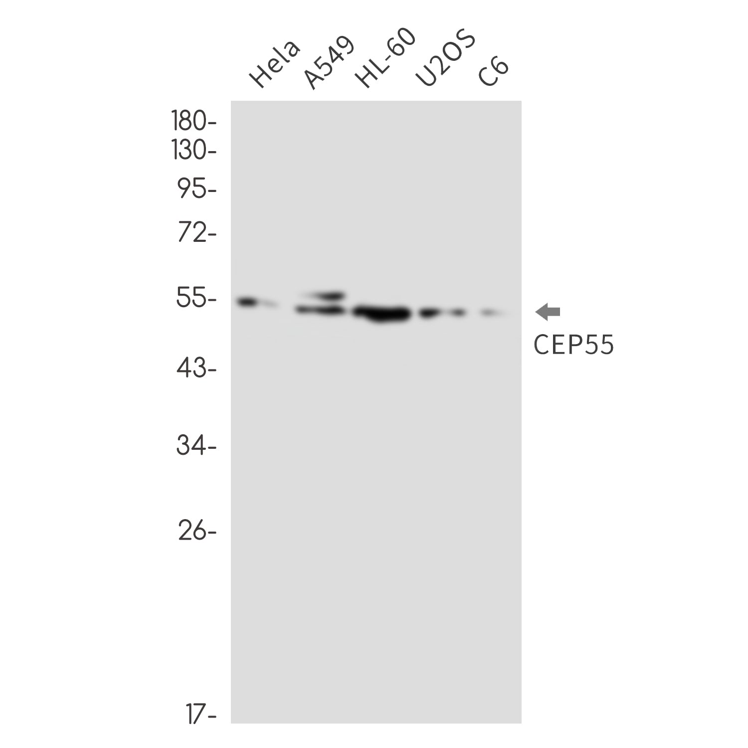Anti-CEP55 Rabbit Monoclonal Antibody