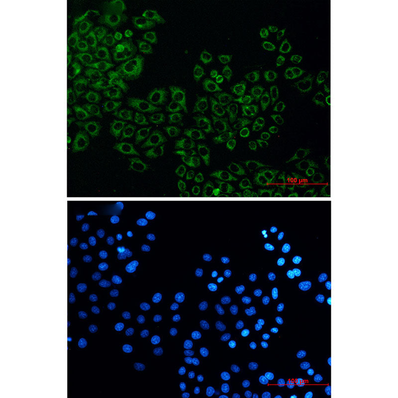 Anti-Citrate Synthetase Rabbit Monoclonal Antibody