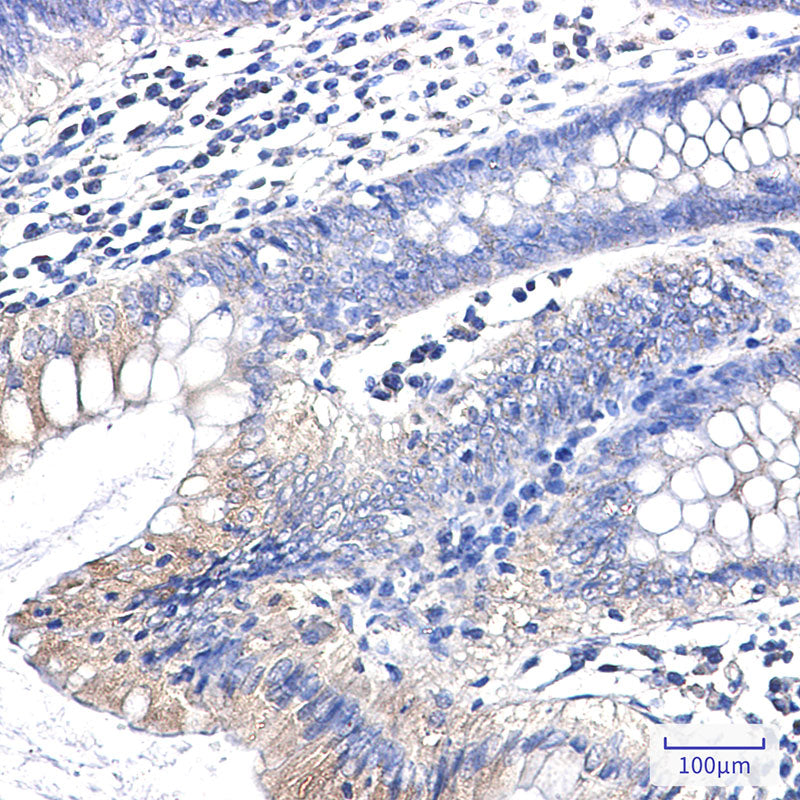 Anti-Clathrin Heavy Chain Rabbit Monoclonal Antibody