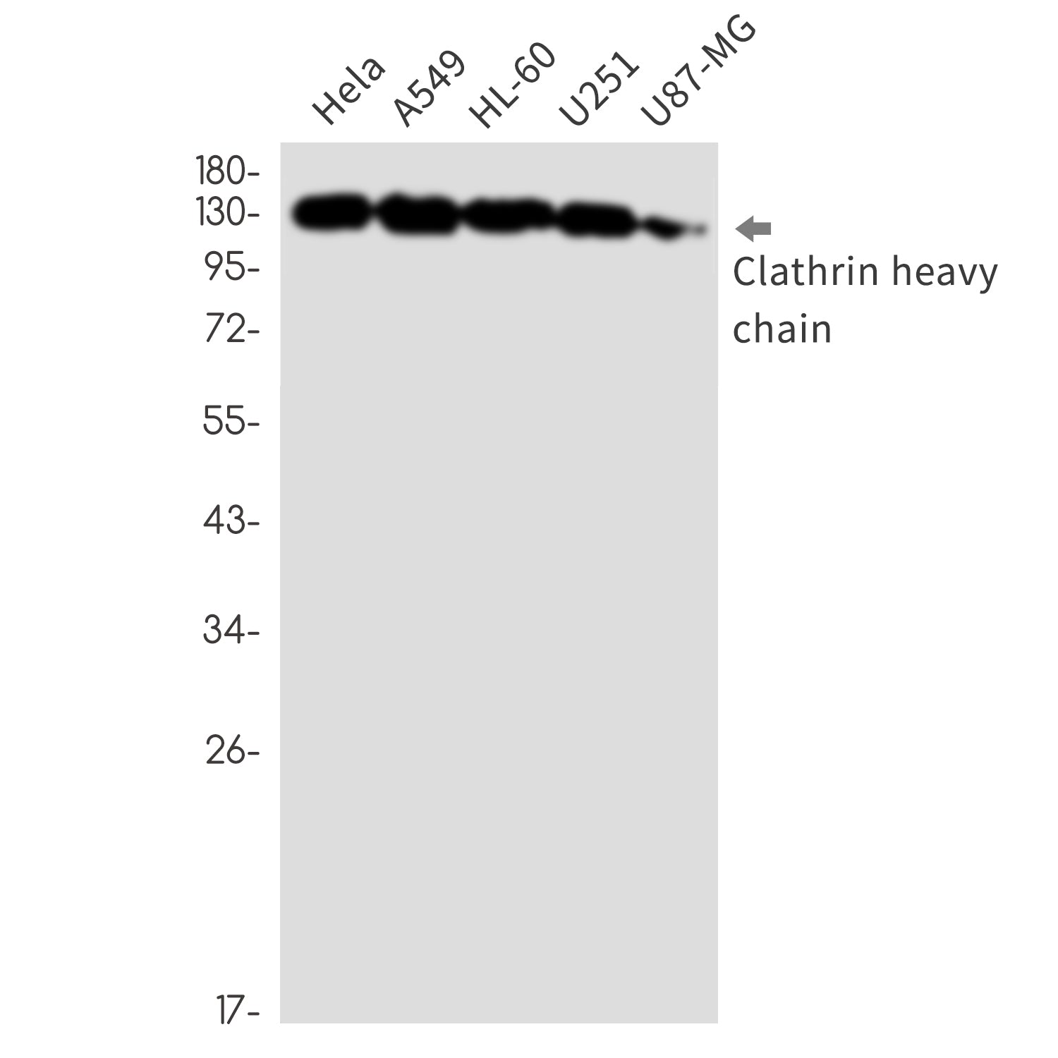Anti-Clathrin Heavy Chain Rabbit Monoclonal Antibody