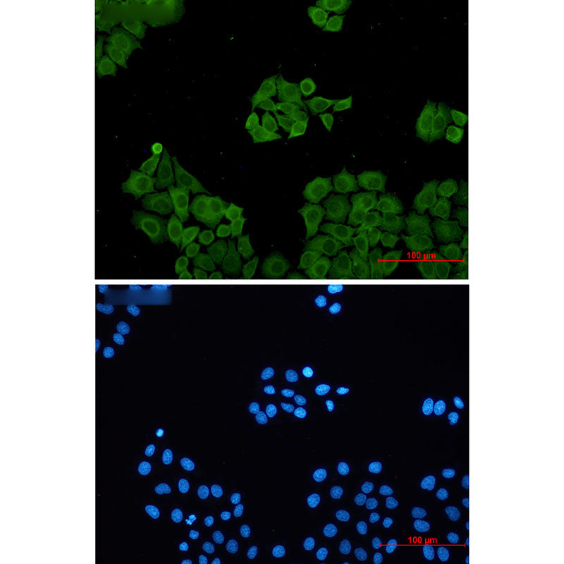 Anti-CLIC1 Rabbit Monoclonal Antibody