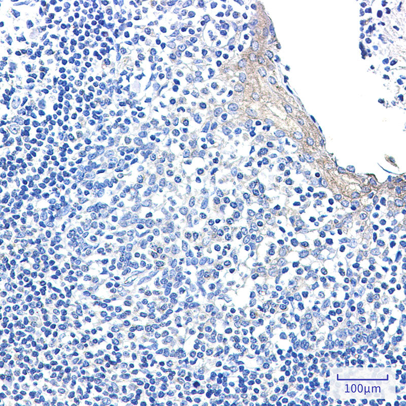 Anti-CLIP170 Rabbit Monoclonal Antibody