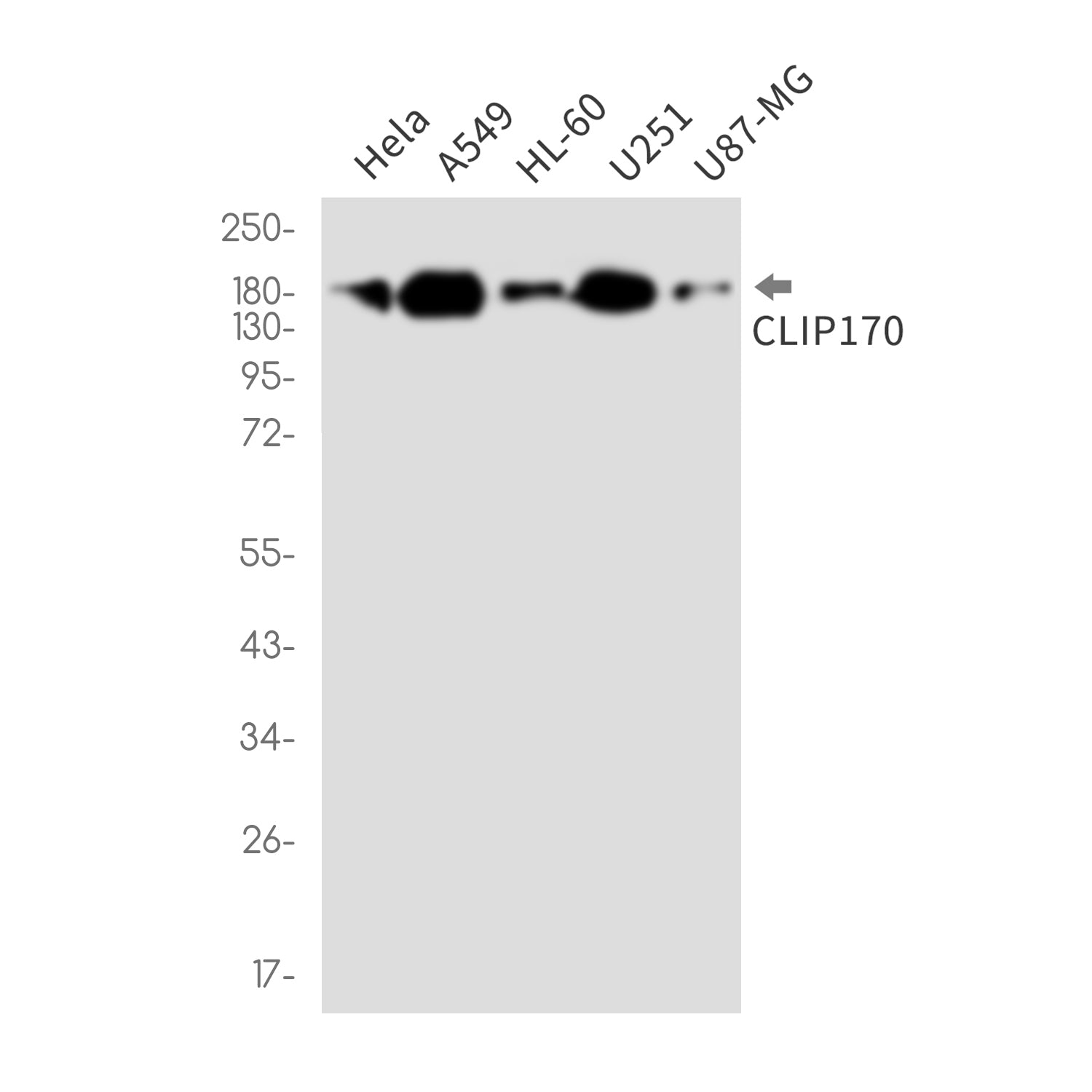 Anti-CLIP170 Rabbit Monoclonal Antibody