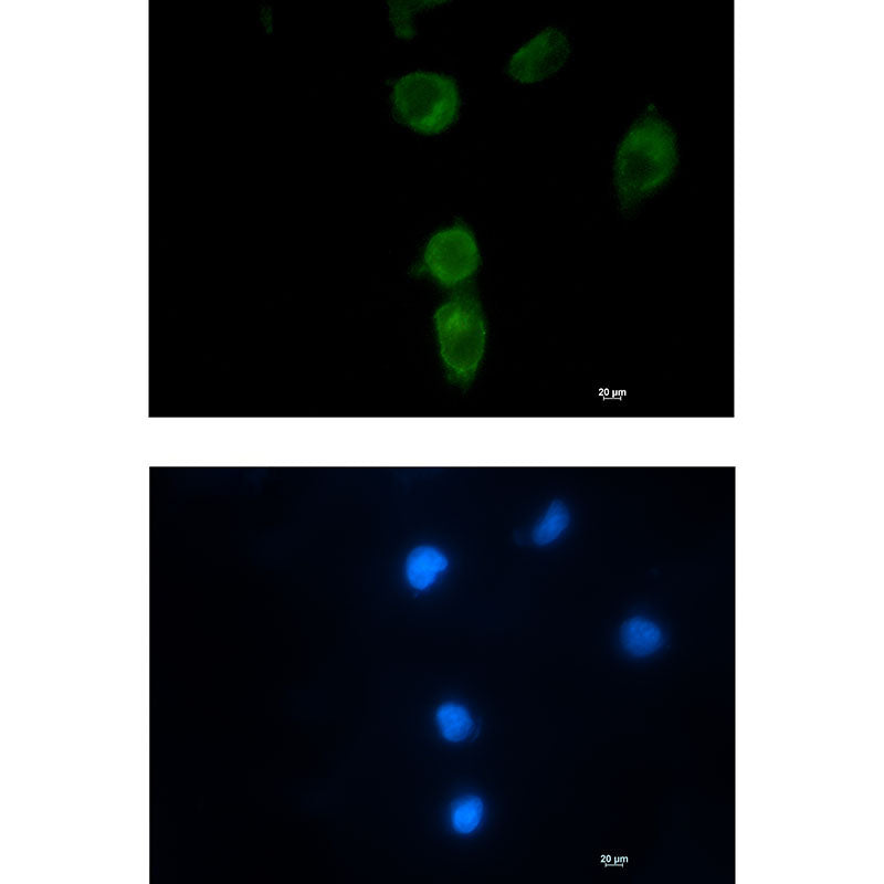 Anti-CLPX Rabbit Monoclonal Antibody
