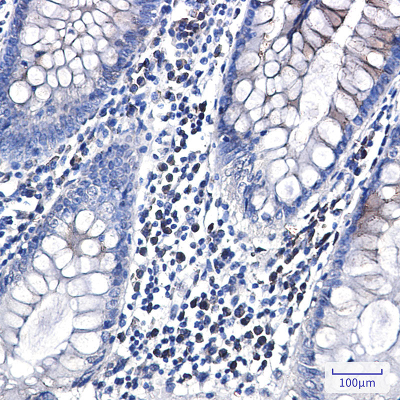 Anti-CLSTN1 Rabbit Monoclonal Antibody