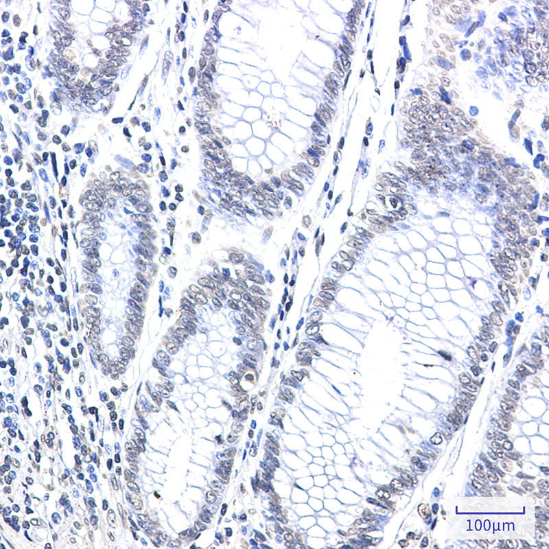 Anti-CPS1 Rabbit Monoclonal Antibody