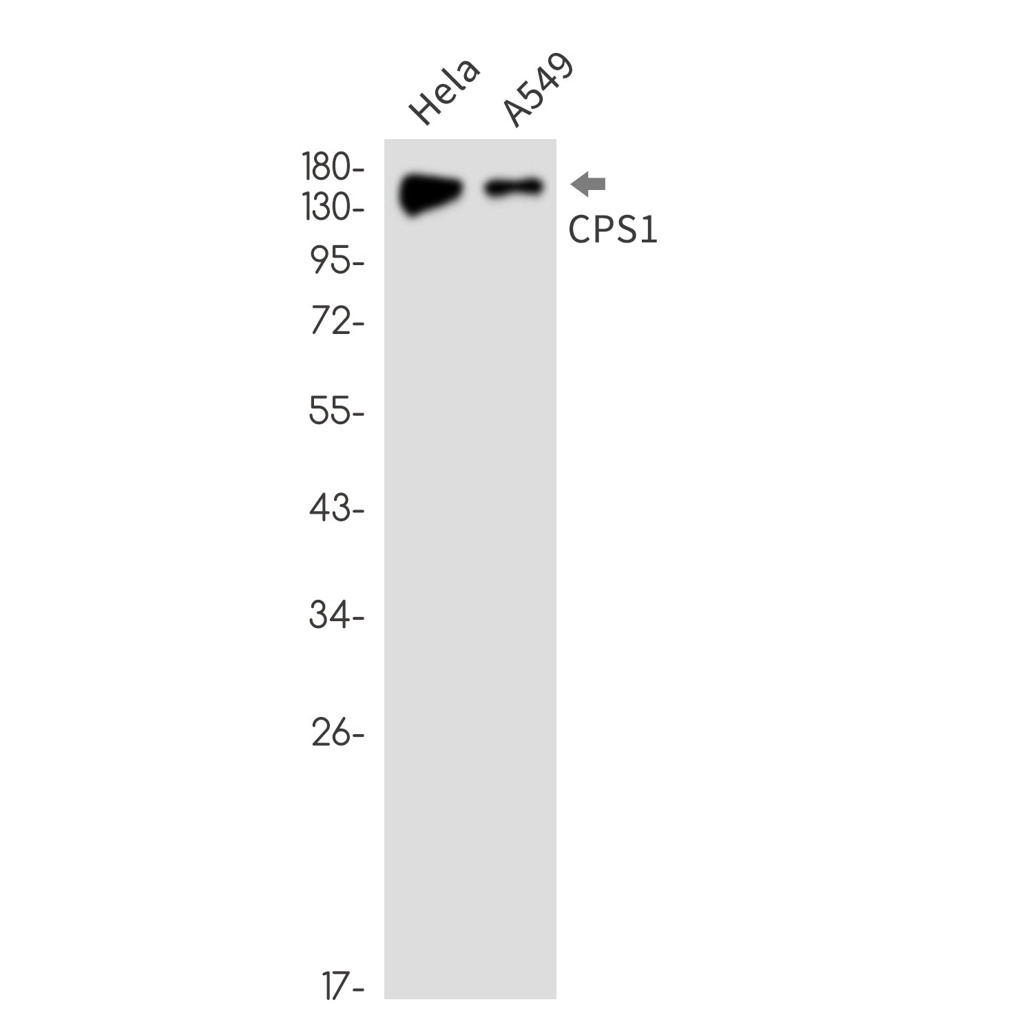 Anti-CPS1 Rabbit Monoclonal Antibody