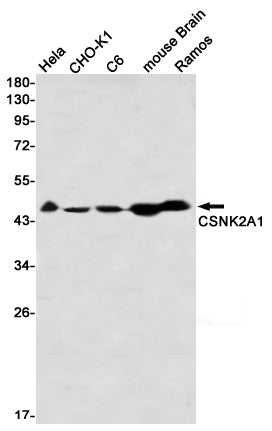Anti-CSNK2A1 Rabbit Monoclonal Antibody