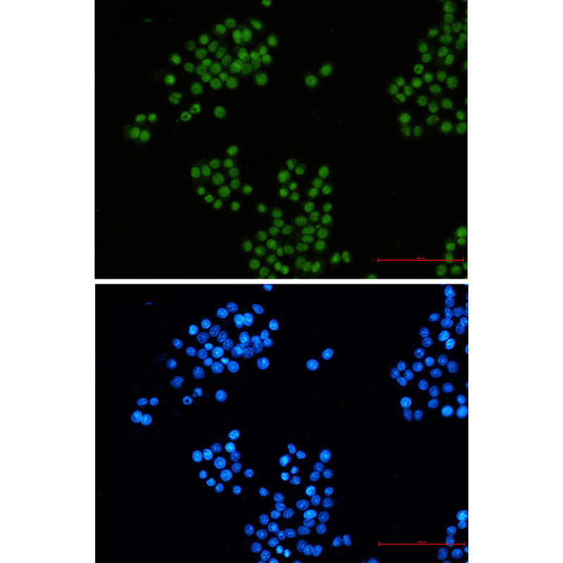Anti-CTBP2 Rabbit Monoclonal Antibody