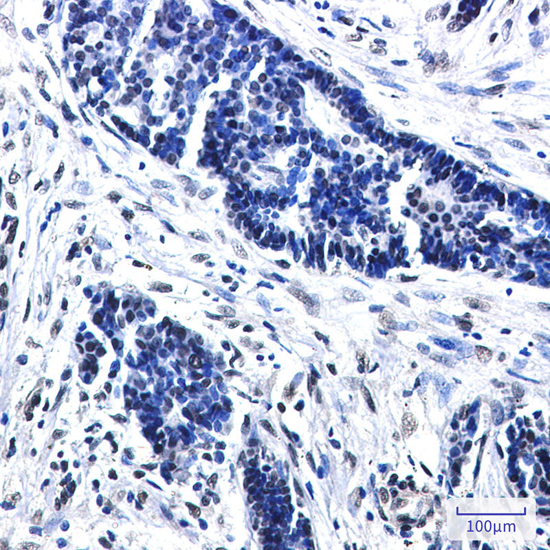Anti-CTBP2 Rabbit Monoclonal Antibody