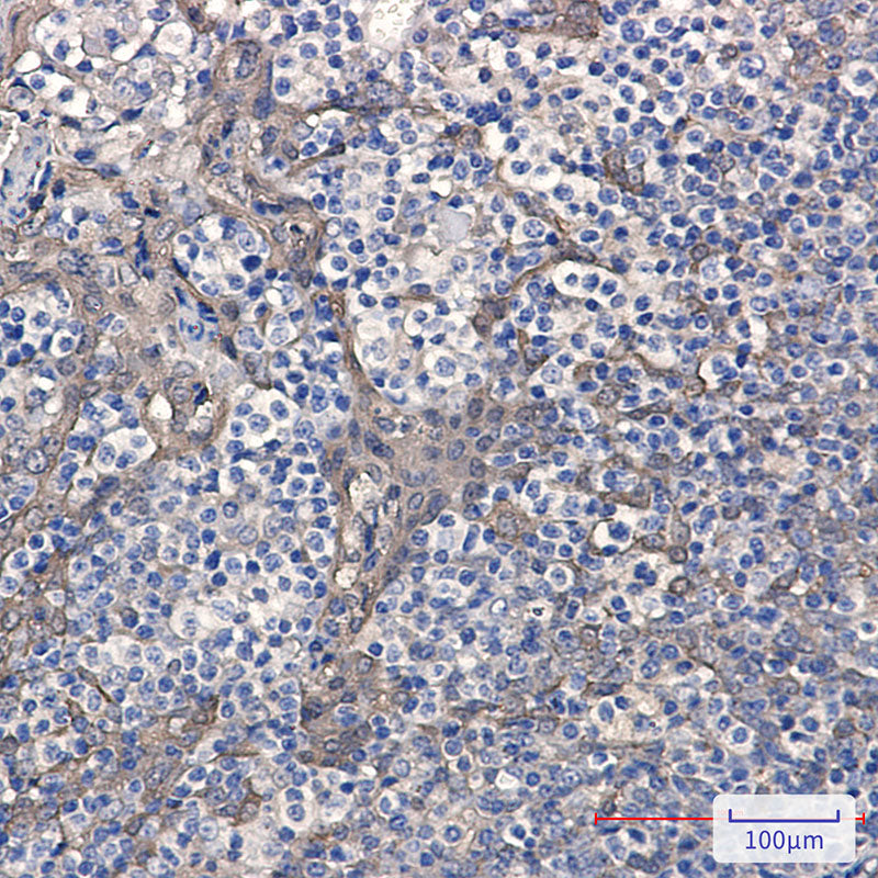 Anti-Cystatin B Rabbit Monoclonal Antibody