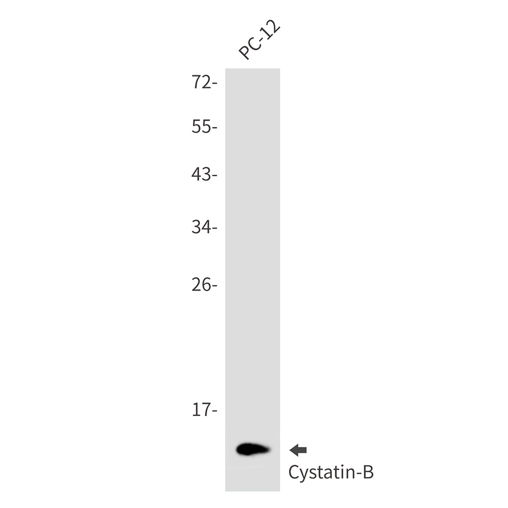 Anti-Cystatin B Rabbit Monoclonal Antibody