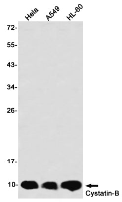 Anti-Cystatin B Rabbit Monoclonal Antibody