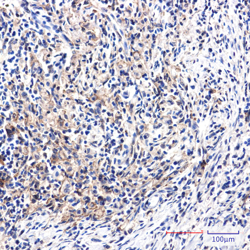 Anti-DAB2 Rabbit Monoclonal Antibody