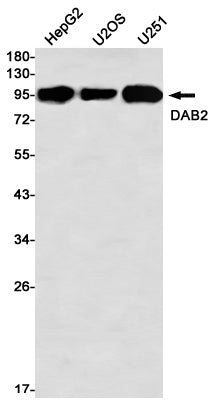 Anti-DAB2 Rabbit Monoclonal Antibody