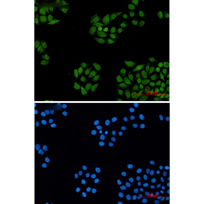 Anti-DDB1 Rabbit Monoclonal Antibody
