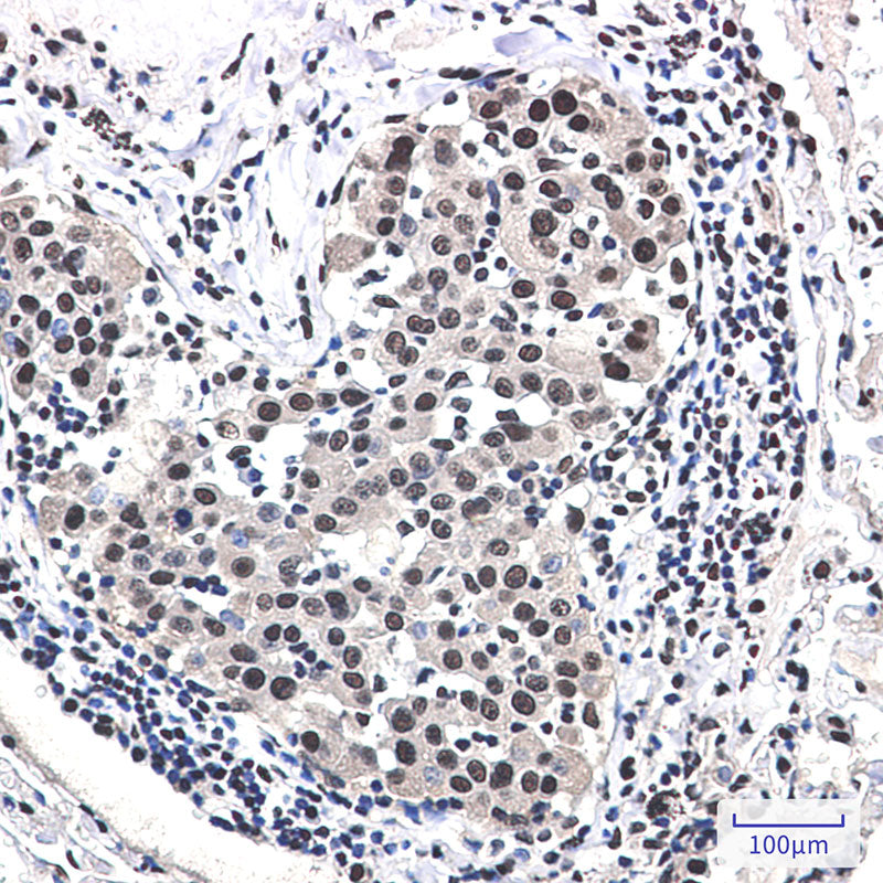 Anti-DDB1 Rabbit Monoclonal Antibody