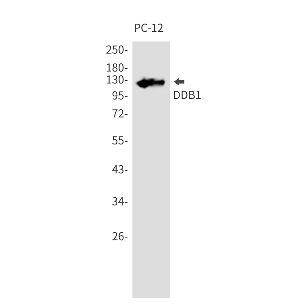 Anti-DDB1 Rabbit Monoclonal Antibody