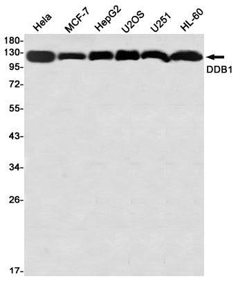 Anti-DDB1 Rabbit Monoclonal Antibody