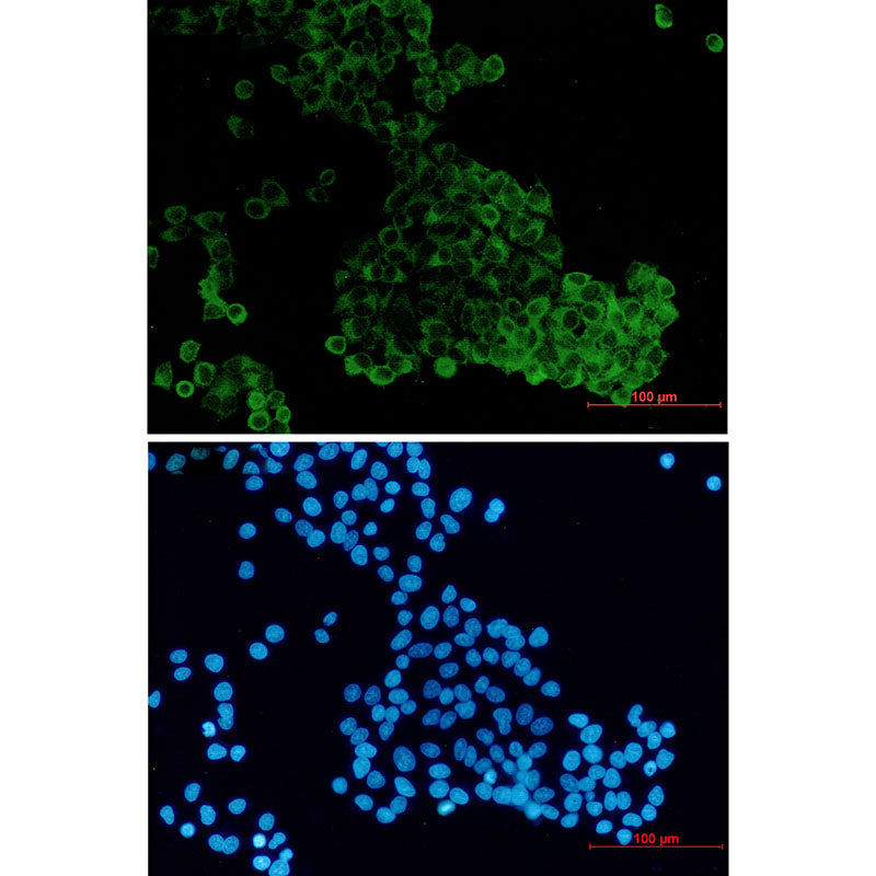 Anti-DENN Rabbit Monoclonal Antibody