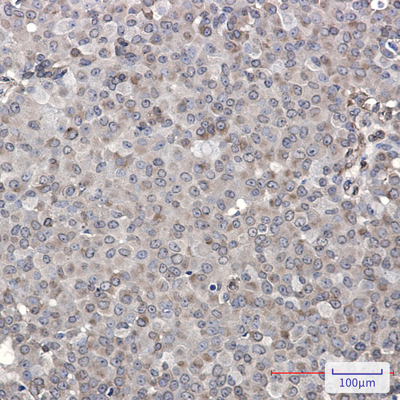 Anti-DENN Rabbit Monoclonal Antibody
