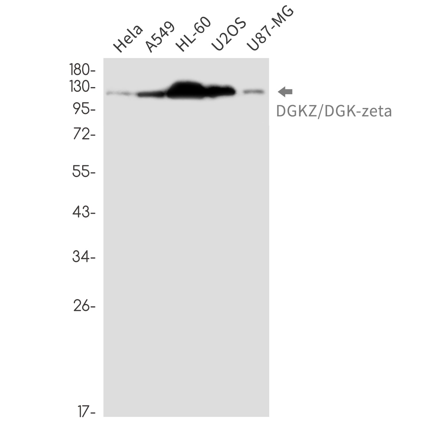 Anti-DGKZ Rabbit Monoclonal Antibody
