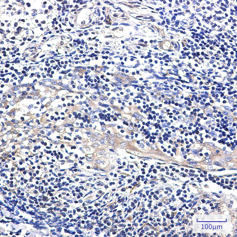 Anti-EBP1 Rabbit Monoclonal Antibody