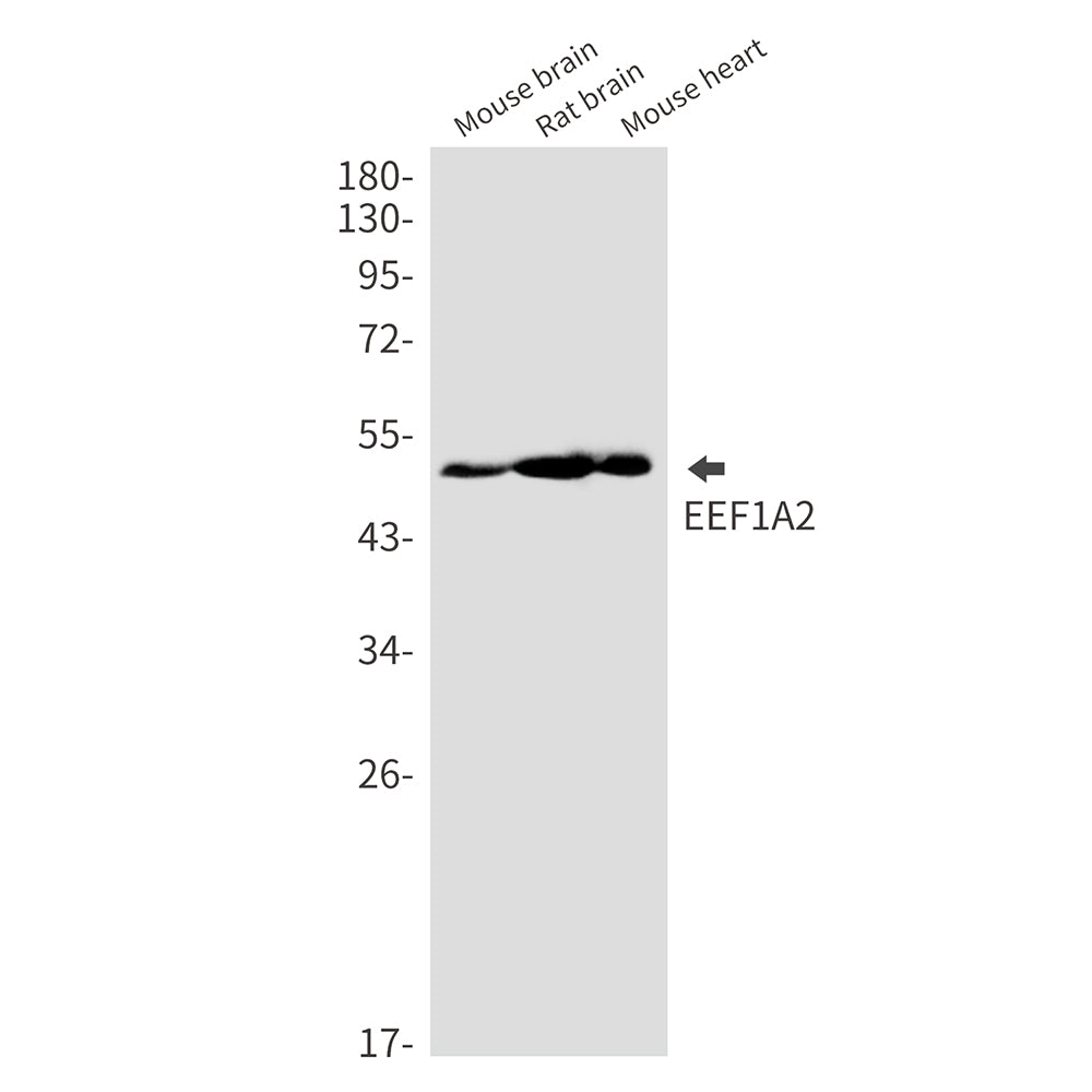 Anti-Elongation Factor 1A2 Rabbit Monoclonal Antibody