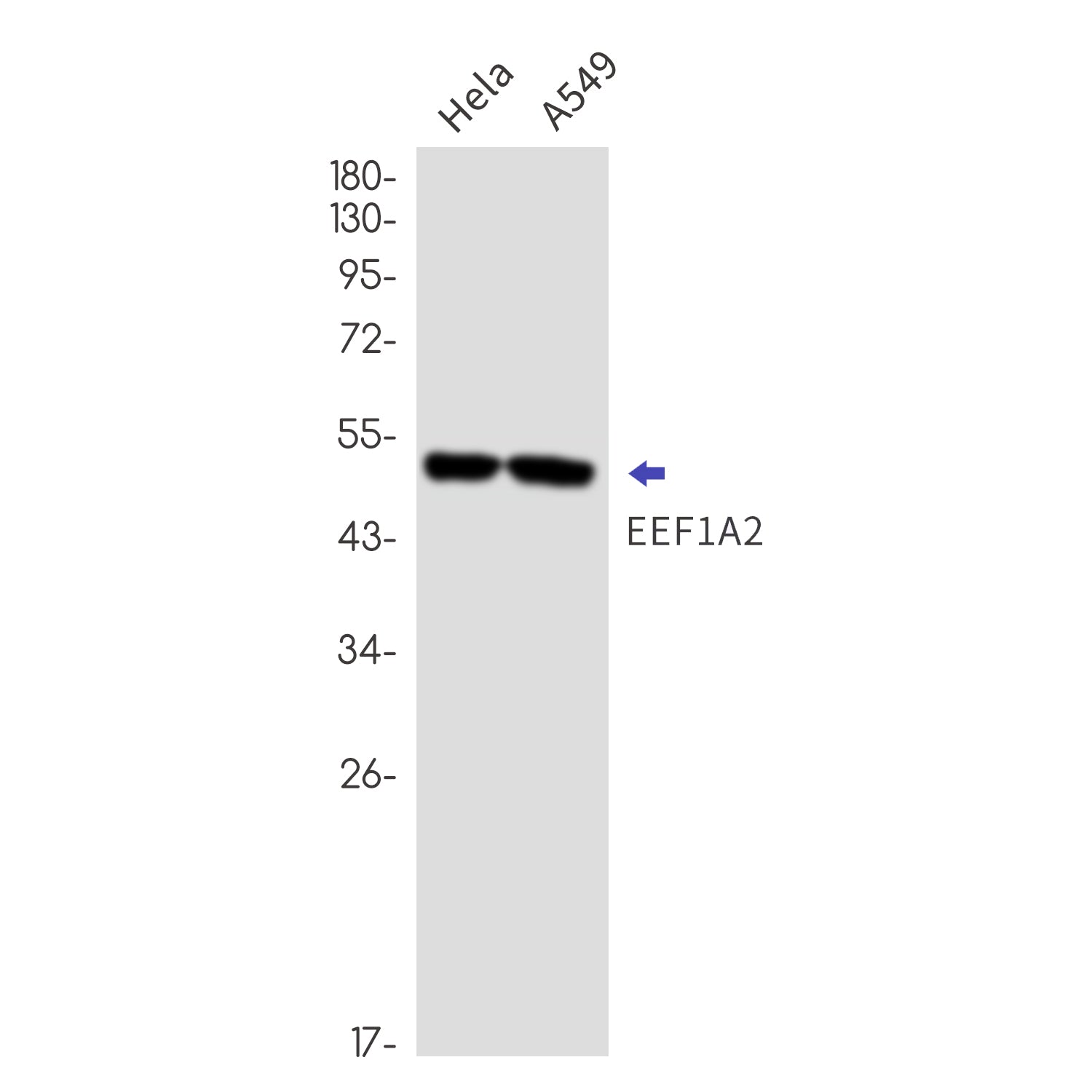 Anti-Elongation Factor 1A2 Rabbit Monoclonal Antibody