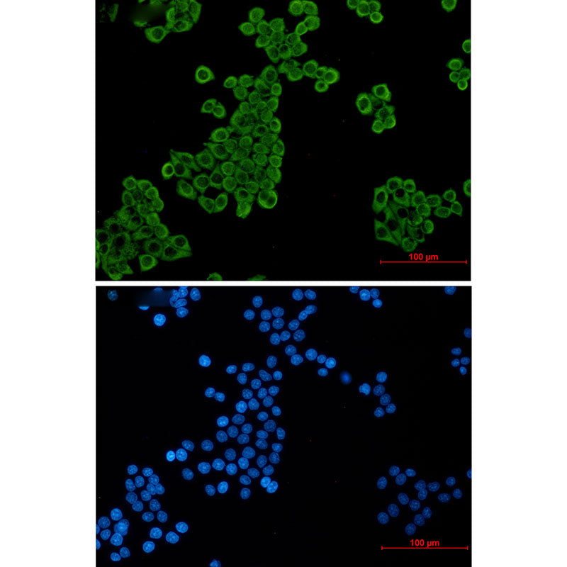 Anti-Elongation factor 2 Rabbit Monoclonal Antibody