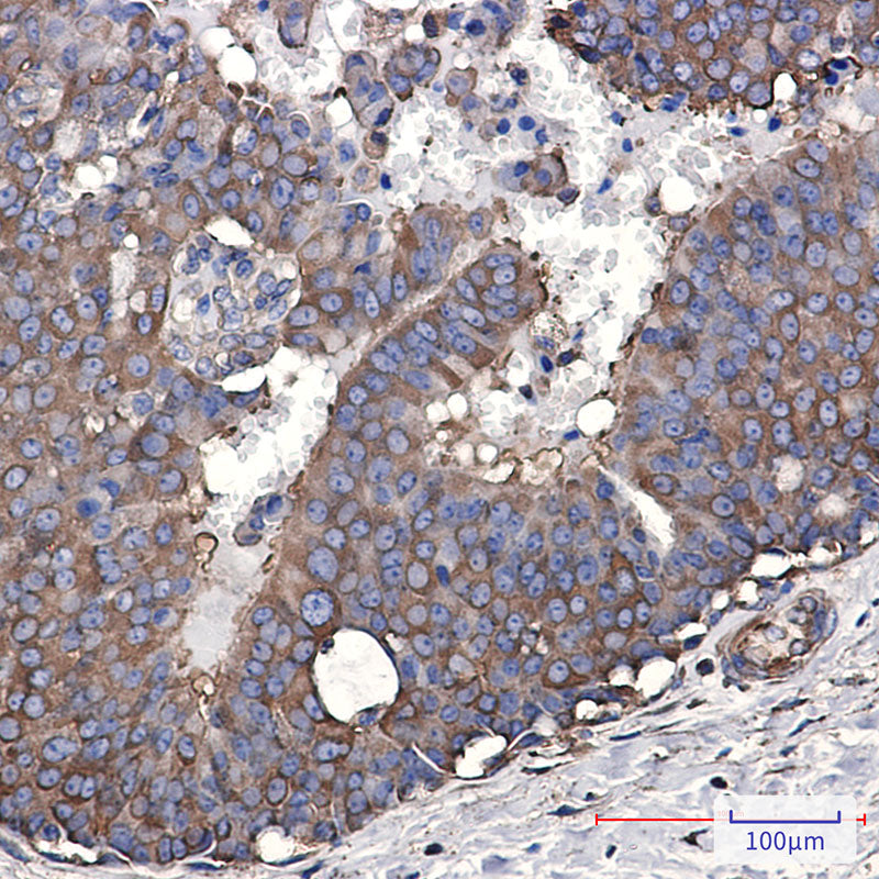 Anti-Elongation factor 2 Rabbit Monoclonal Antibody