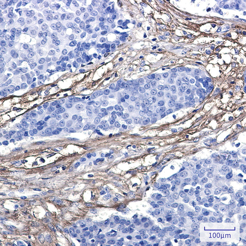 Anti-EFEMP1 Rabbit Monoclonal Antibody