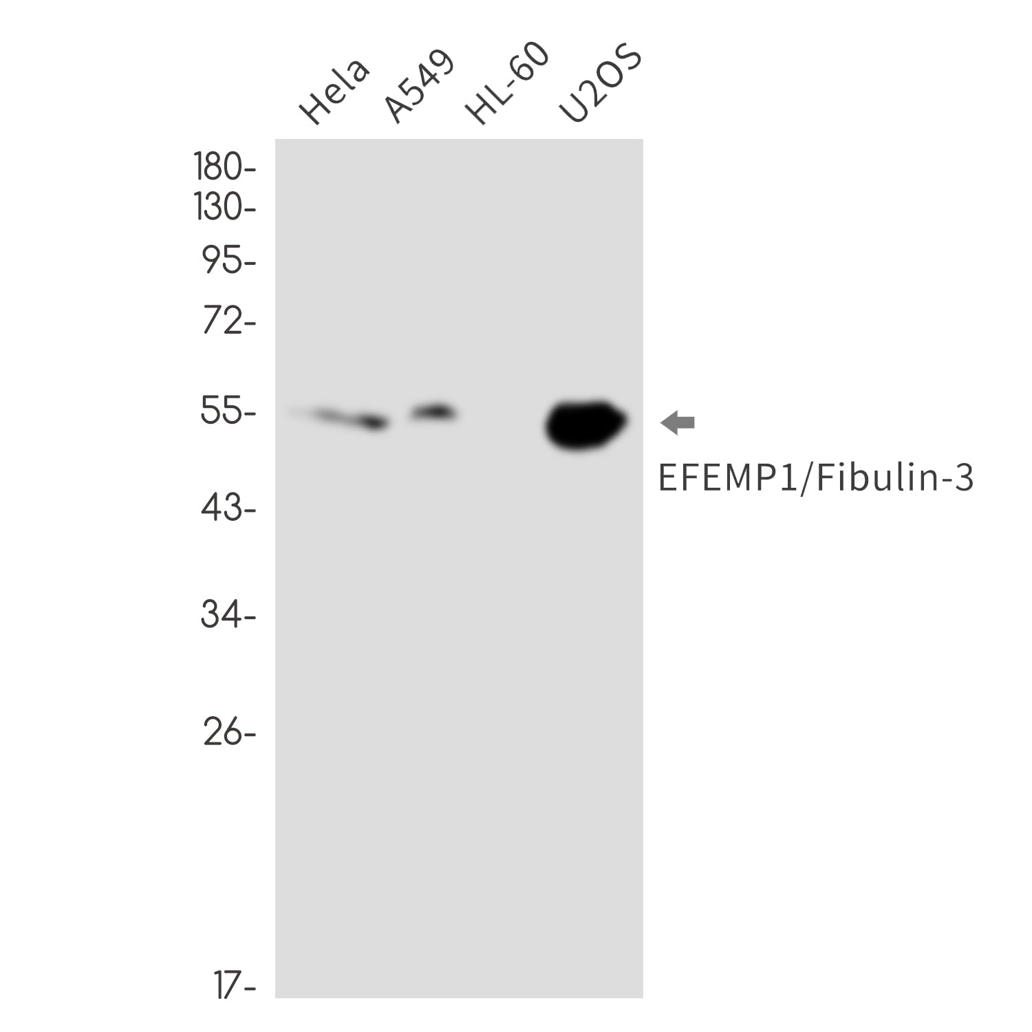Anti-EFEMP1 Rabbit Monoclonal Antibody