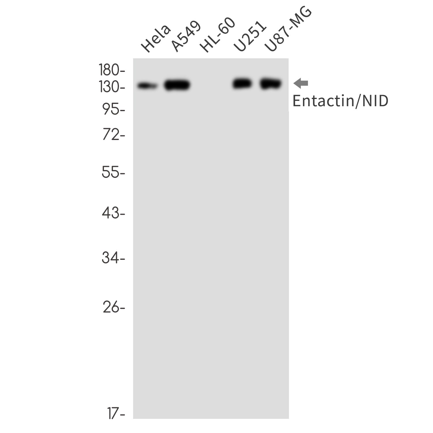 Anti-Entactin Rabbit Monoclonal Antibody