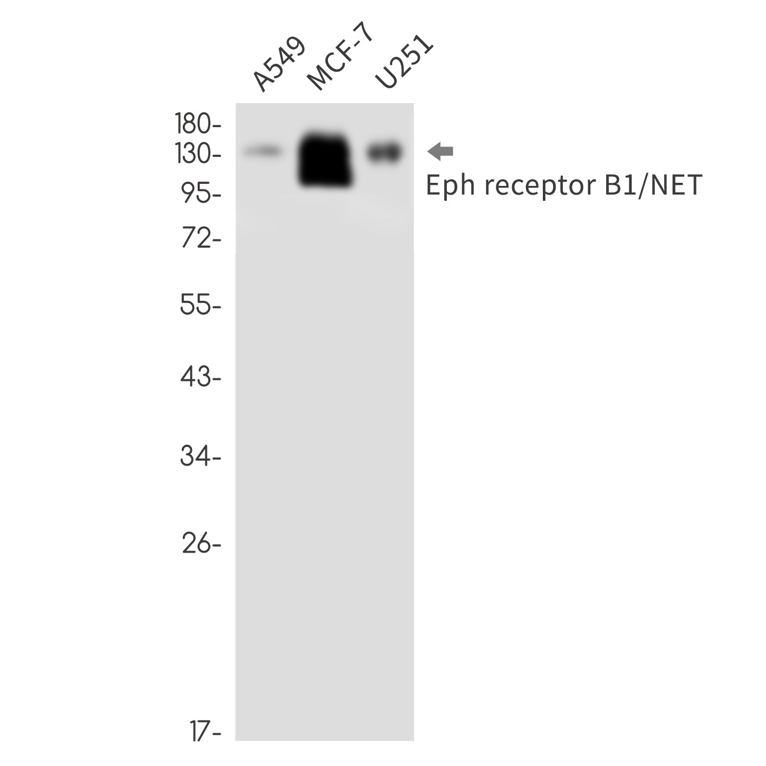 Anti-Ephrin Receptor B1 Rabbit Monoclonal Antibody