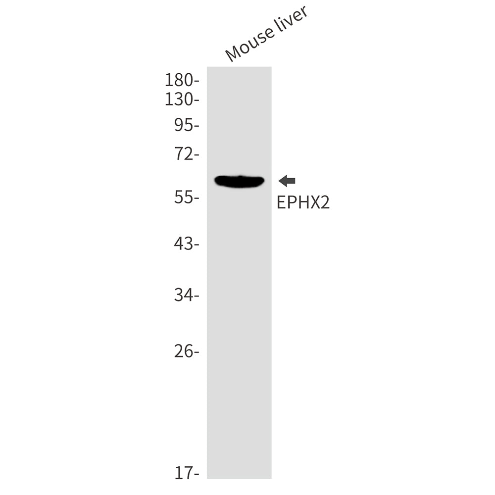 Anti-Epoxide Hydrolase 1 Rabbit Monoclonal Antibody