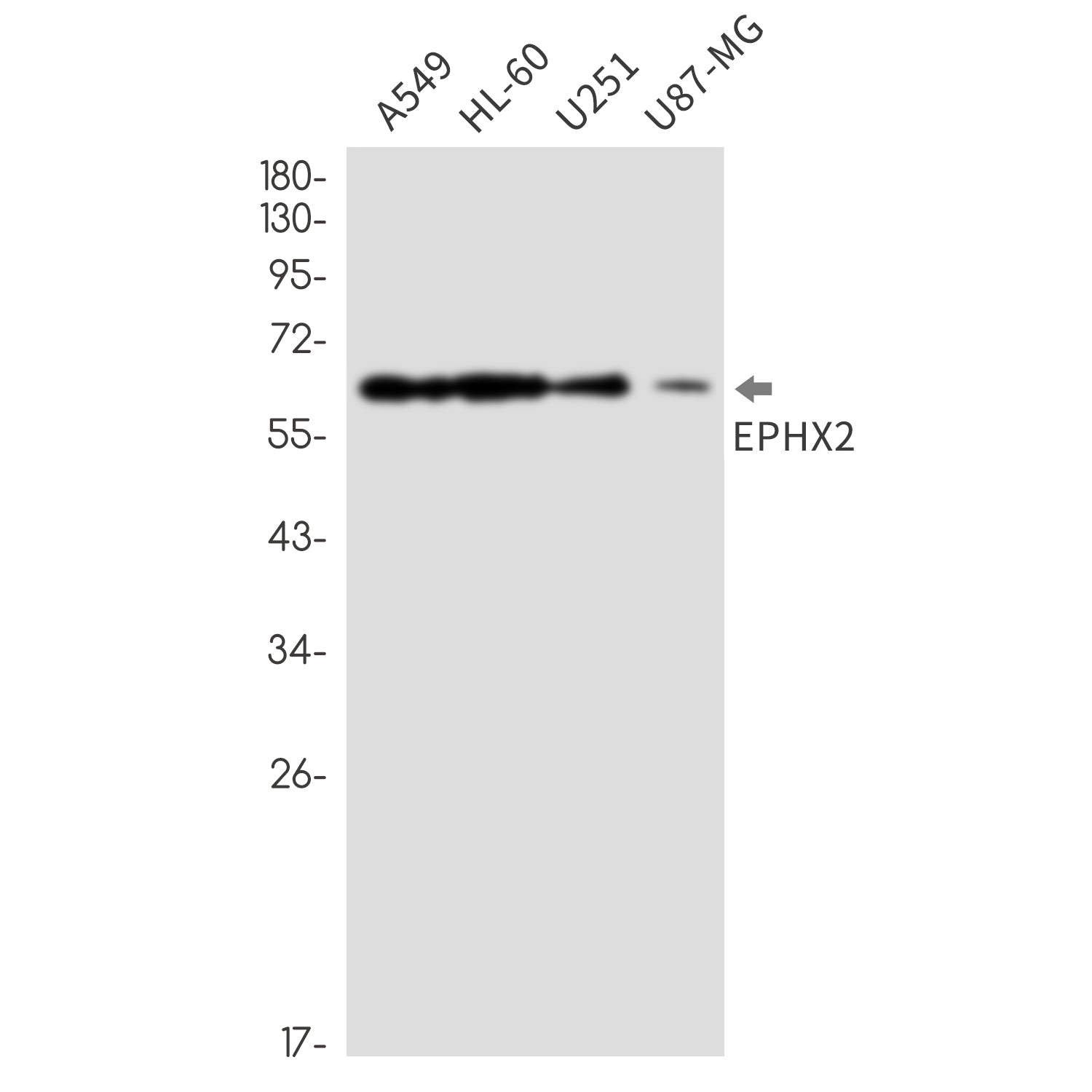 Anti-Epoxide Hydrolase 1 Rabbit Monoclonal Antibody