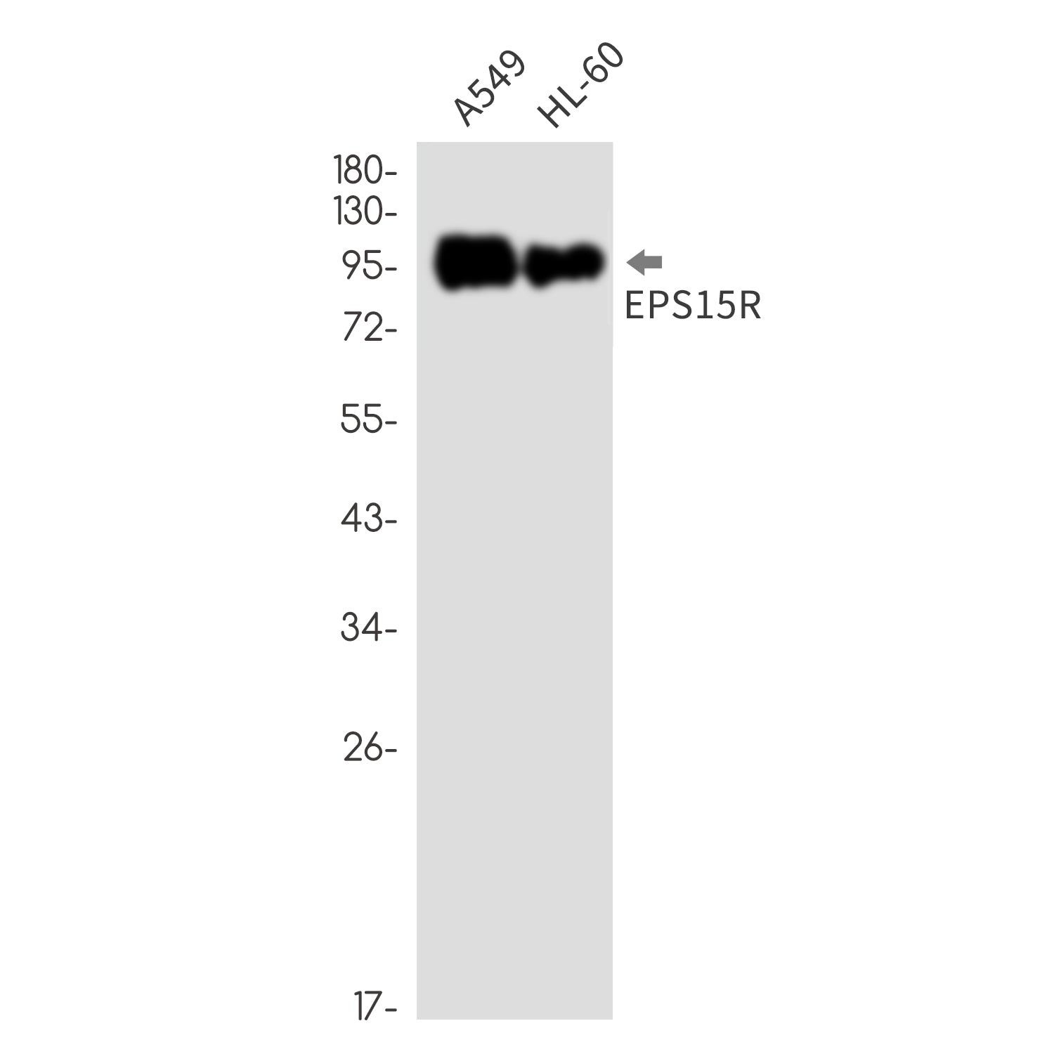 Anti-EPS15R Rabbit Monoclonal Antibody