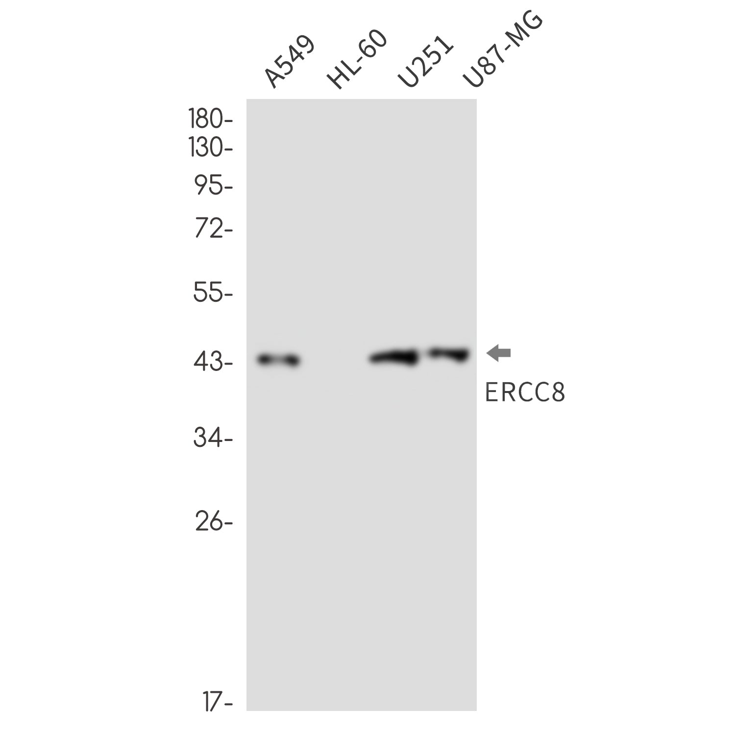 Anti-ERCC8 Rabbit Monoclonal Antibody