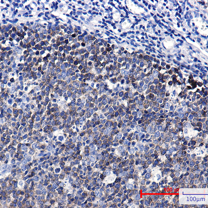 Anti-Ezrin Rabbit Monoclonal Antibody