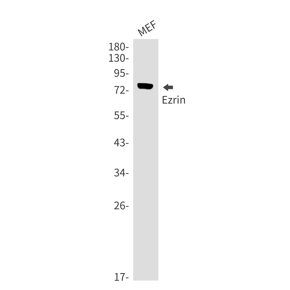 Anti-Ezrin Rabbit Monoclonal Antibody