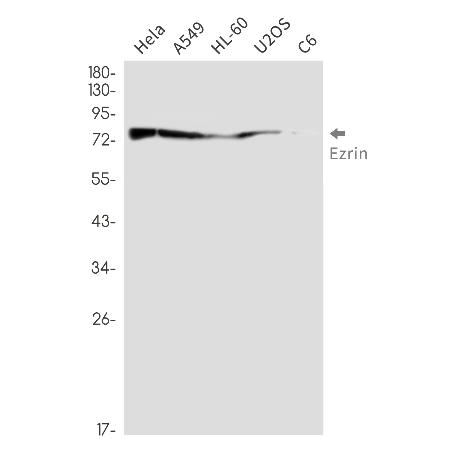 Anti-Ezrin Rabbit Monoclonal Antibody