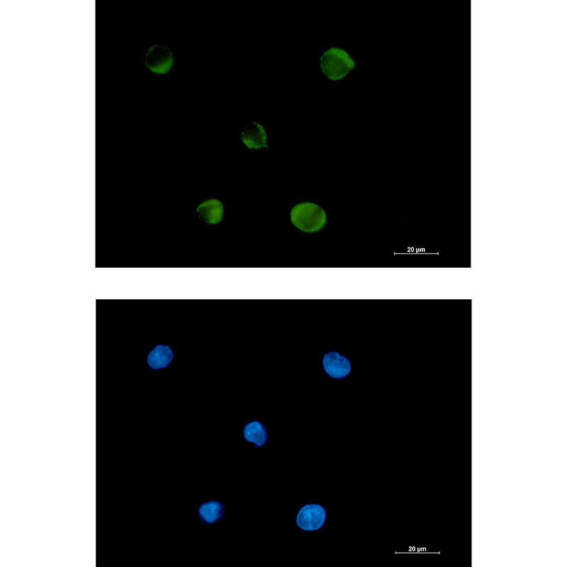 Anti-FADS1 Rabbit Monoclonal Antibody
